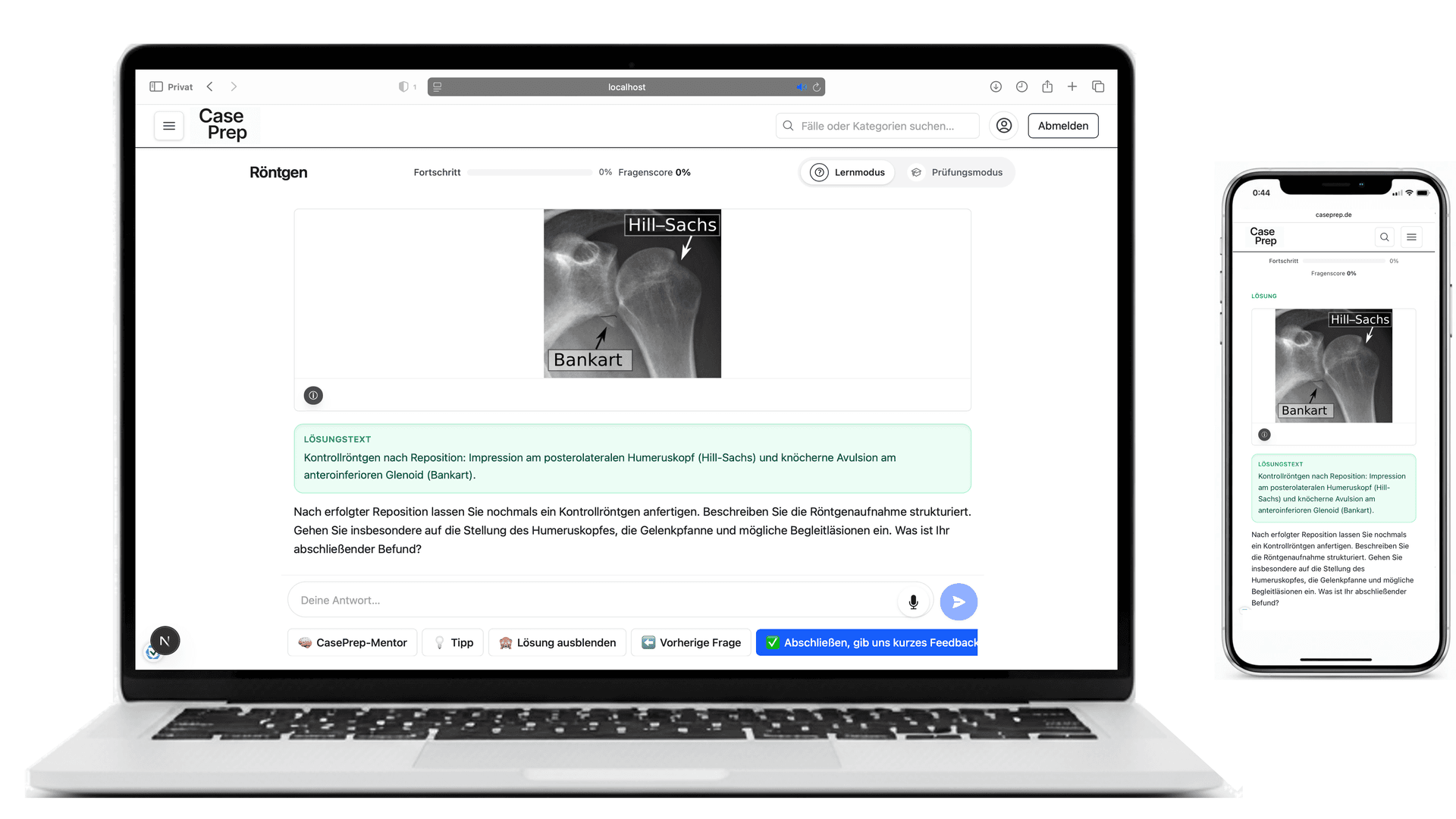 Detailgrafik für weiterführende Röntgenfälle