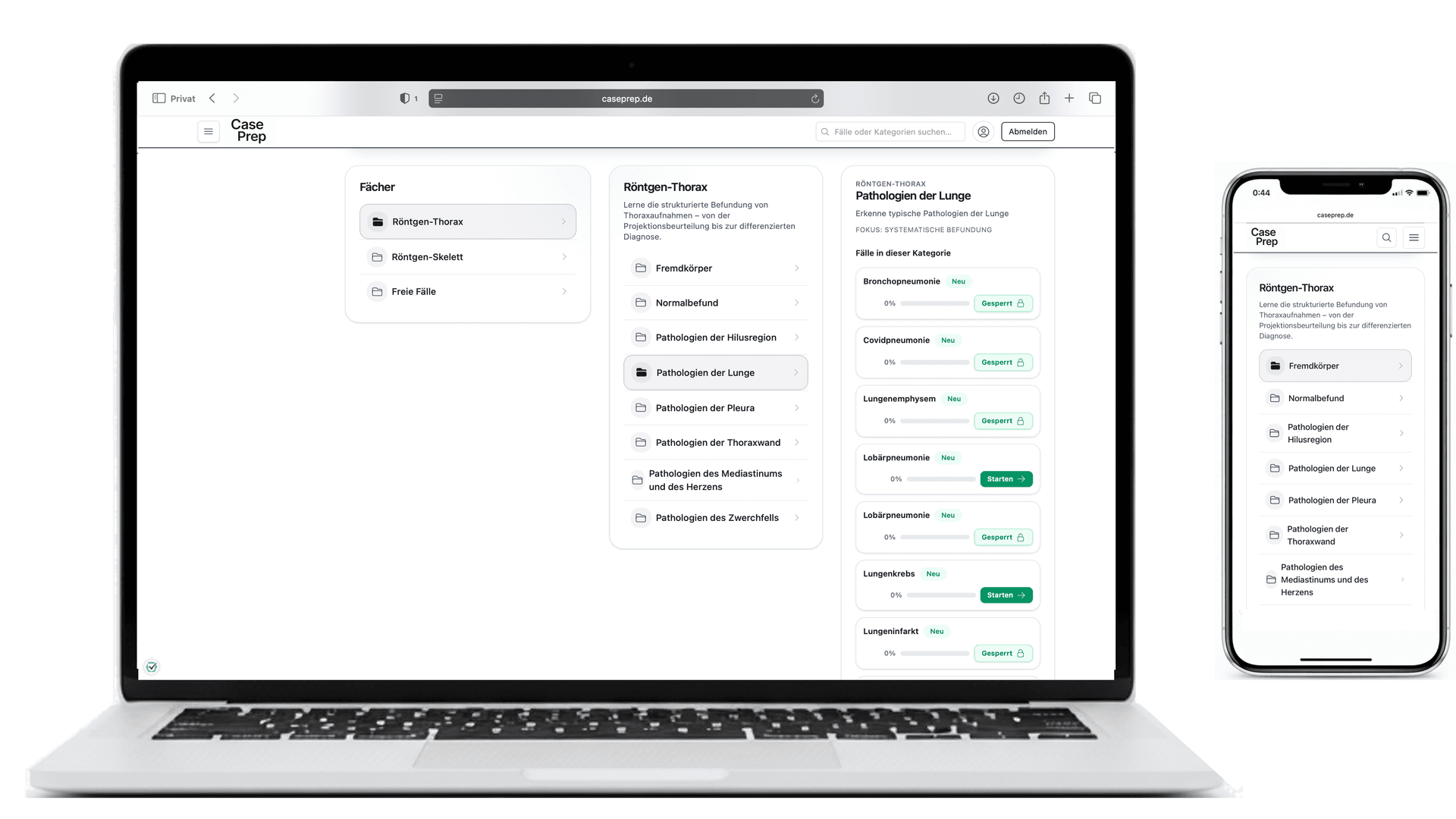 Dummy-Grafik für Röntgen-Fallkategorien