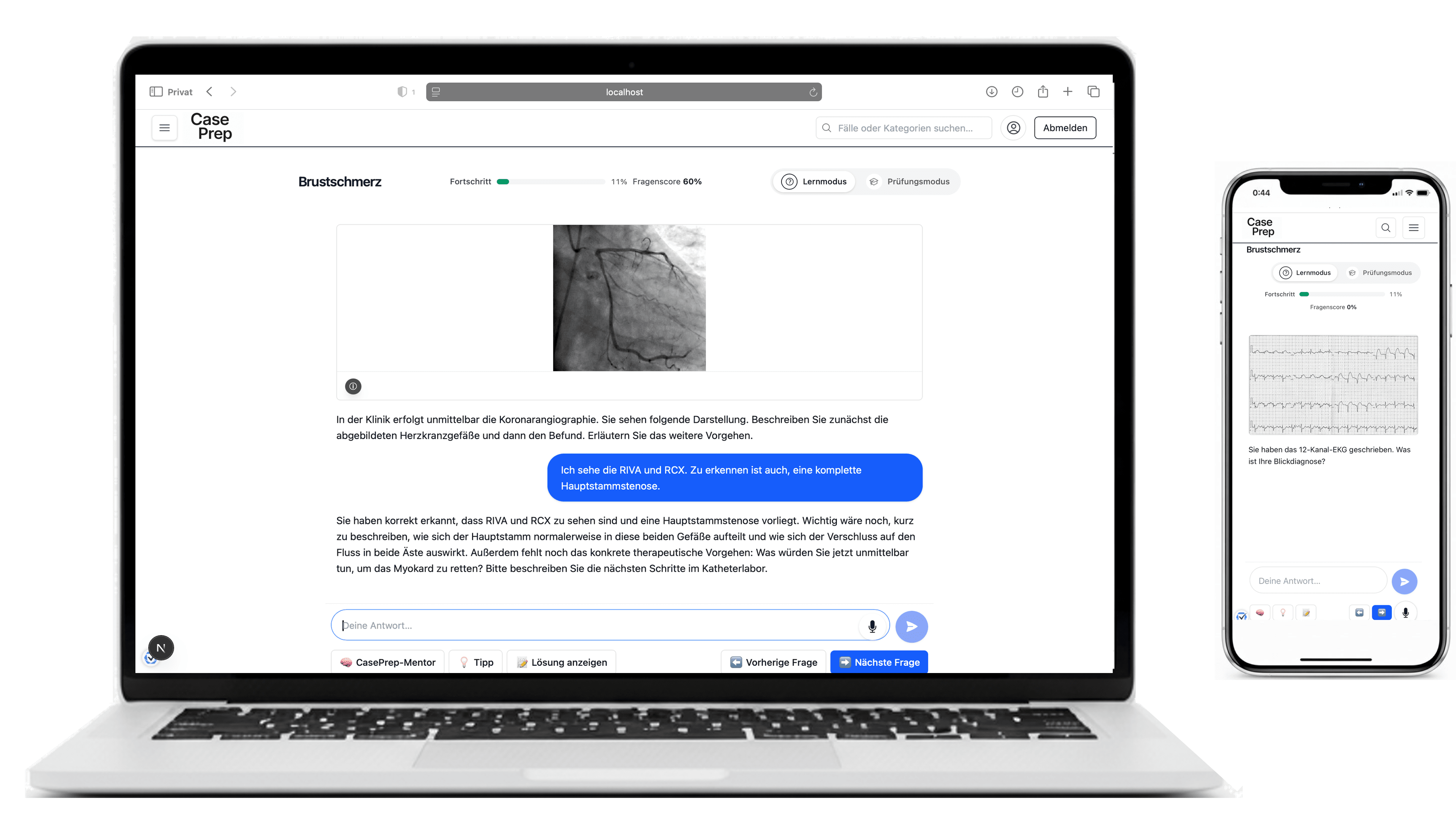 Mockup einer CasePrep Fallsimulation auf Laptop und Tablet